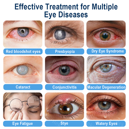 Rekulo® OptiMist Eye Spray✅FDA Approved (For dry eyes, blurry vision,presbyopia, and cataracts) 👀